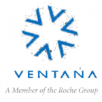 Contact Ventana Medical Systems customer service phone numbers